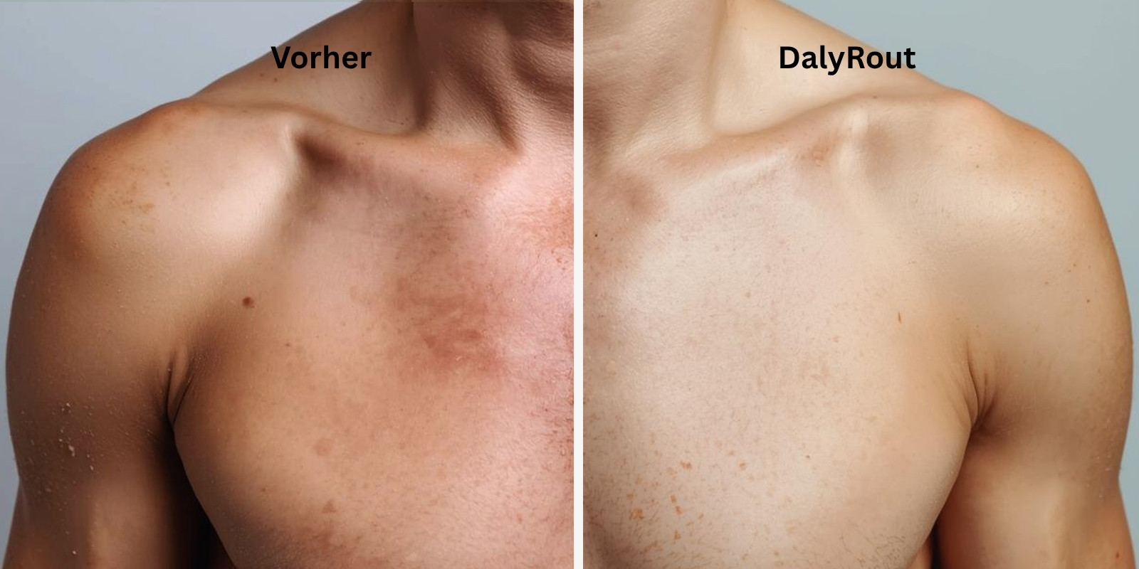 dalyrout-vorher-nachher-vergleich